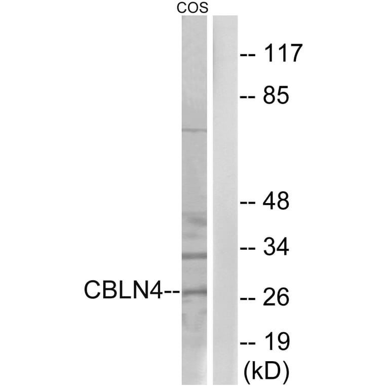 Western Blot - Anti-CBLN4 Antibody (C15059) - Antibodies.com