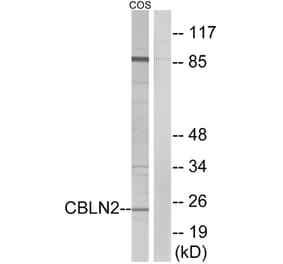 Western Blot - Anti-CBLN2 Antibody (C15057) - Antibodies.com
