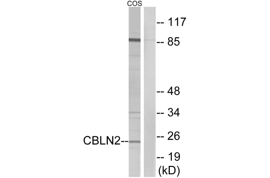 Western Blot - Anti-CBLN2 Antibody (C15057) - Antibodies.com