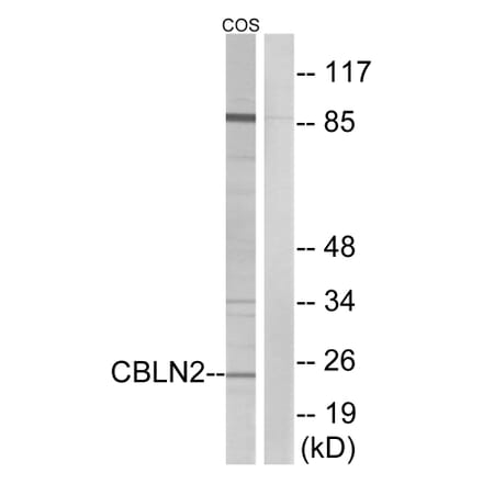 Western Blot - Anti-CBLN2 Antibody (C15057) - Antibodies.com