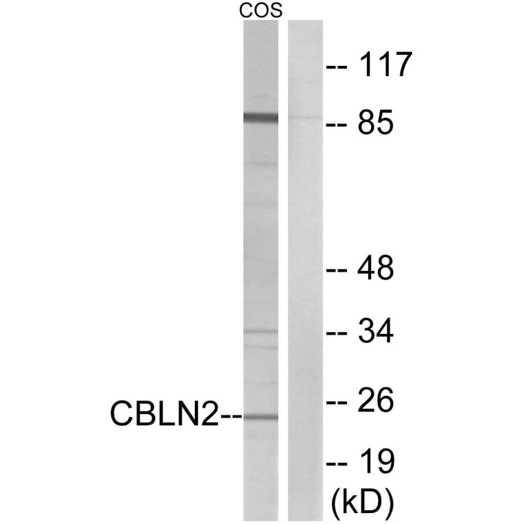 Western Blot - Anti-CBLN2 Antibody (C15057) - Antibodies.com
