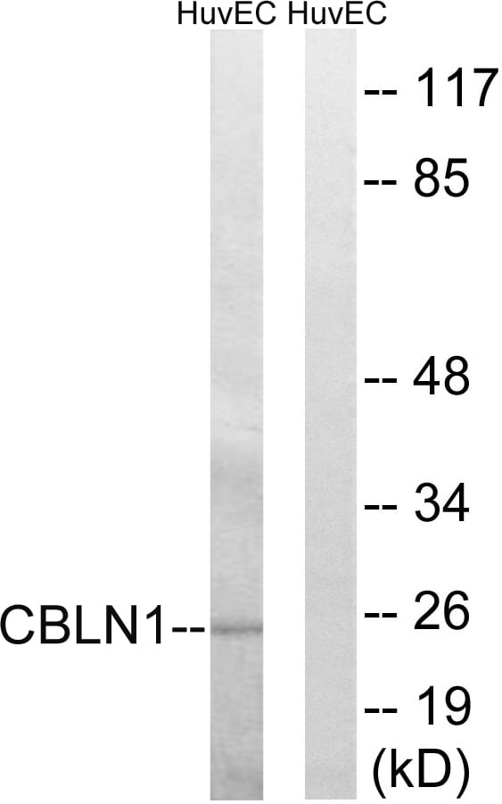 Western blot analysis of lysates from HUVEC cells using Anti-CBLN1 Antibody. The right hand lane represents a negative control, where the antibody is blocked by the immunising peptide.