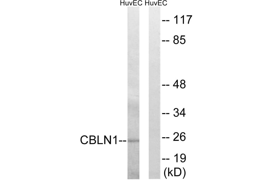 Western Blot - Anti-CBLN1 Antibody (C15056) - Antibodies.com