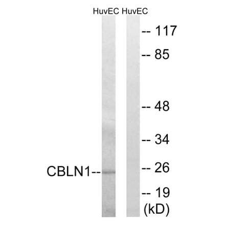 Western Blot - Anti-CBLN1 Antibody (C15056) - Antibodies.com