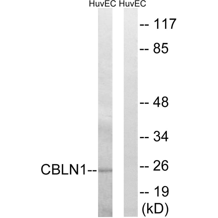 Western Blot - Anti-CBLN1 Antibody (C15056) - Antibodies.com