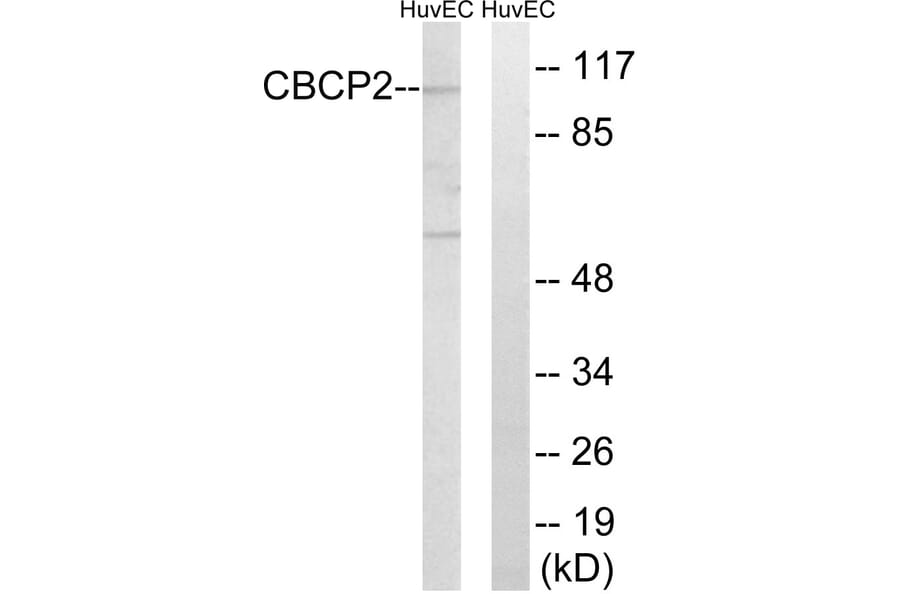 Western Blot - Anti-CBCP2 Antibody (C15300) - Antibodies.com