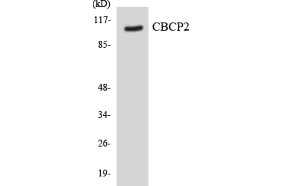 Western Blot - Anti-CBCP2 Antibody (R12-2572) - Antibodies.com