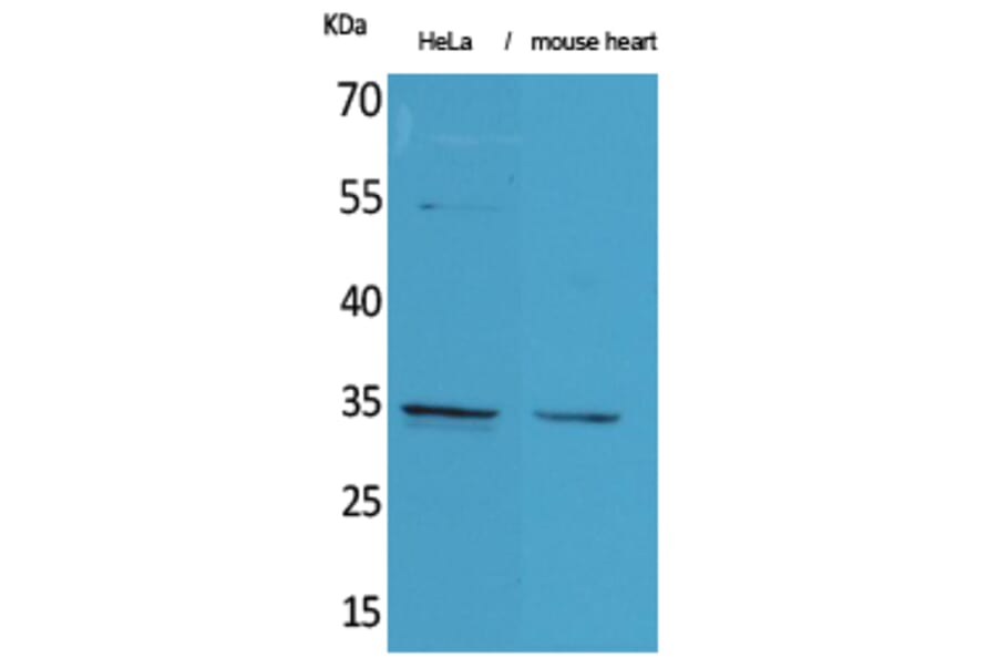 Immunohistochemistry - Anti-CASP3 Antibody (C30154) - Antibodies.com
