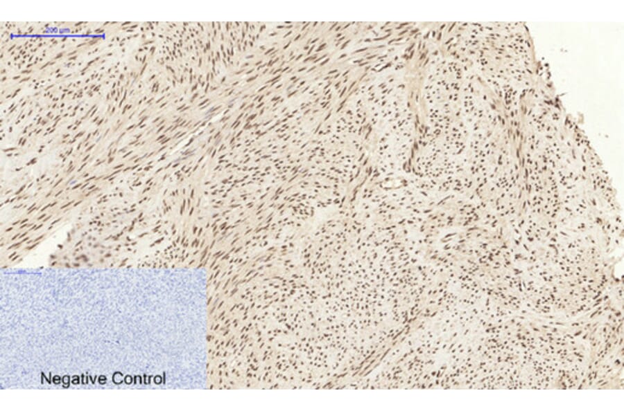Immunohistochemistry - Anti-CASP3 Antibody (C30154) - Antibodies.com