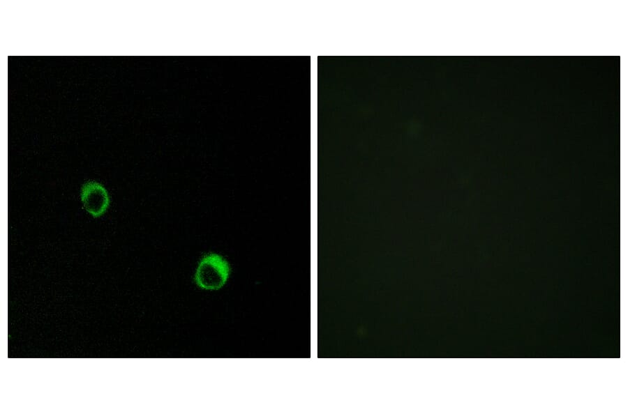 Immunofluorescence - Anti-CAR14 Antibody (C12114) - Antibodies.com