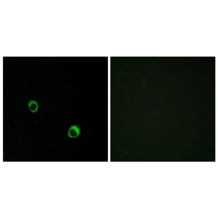 Immunofluorescence - Anti-CAR14 Antibody (C12114) - Antibodies.com