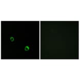 Immunofluorescence - Anti-CAR14 Antibody (C12114) - Antibodies.com