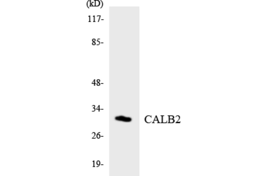 Western Blot - Anti-CALB2 Antibody (R12-2565) - Antibodies.com