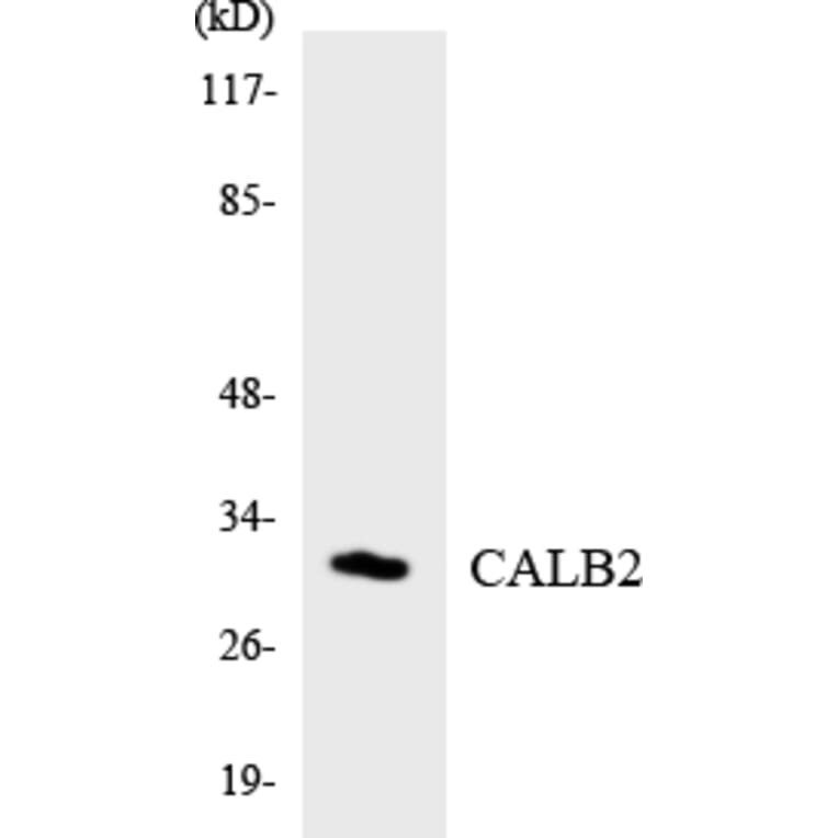 Western Blot - Anti-CALB2 Antibody (R12-2565) - Antibodies.com