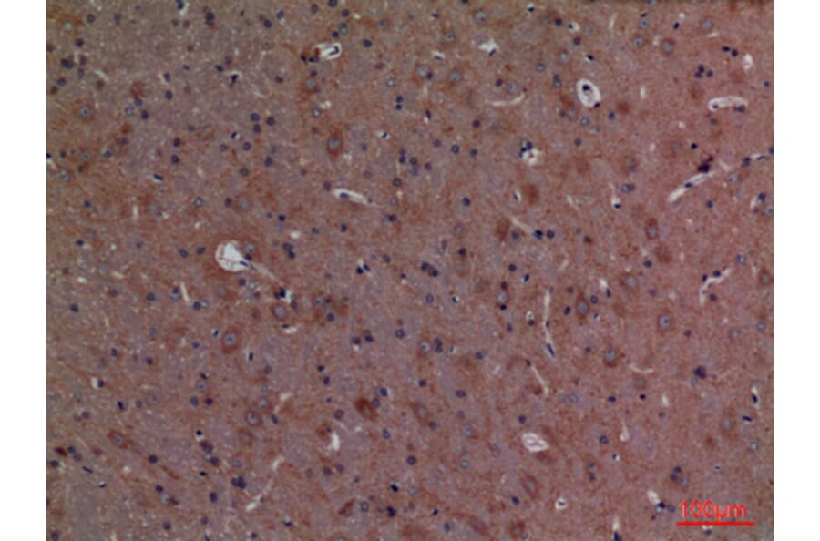 Immunohistochemistry - Anti-CALB1 Antibody (C30183) - Antibodies.com