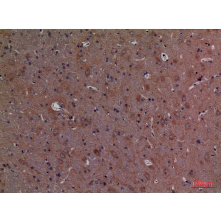 Immunohistochemistry - Anti-CALB1 Antibody (C30183) - Antibodies.com