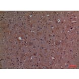 Immunohistochemistry - Anti-CALB1 Antibody (C30183) - Antibodies.com