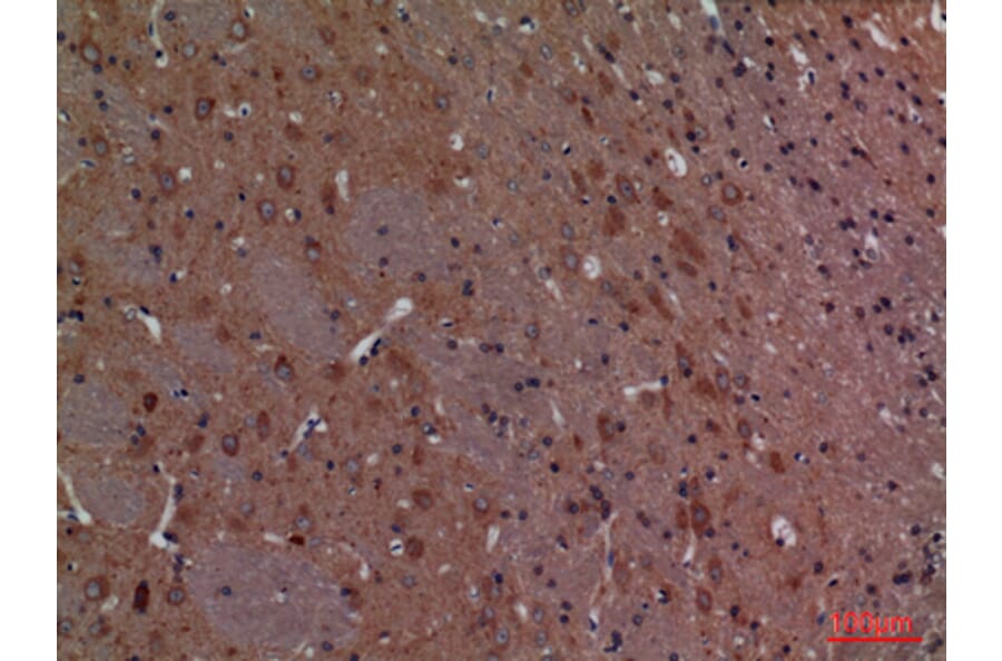 Immunohistochemistry - Anti-CALB1 Antibody (C30183) - Antibodies.com