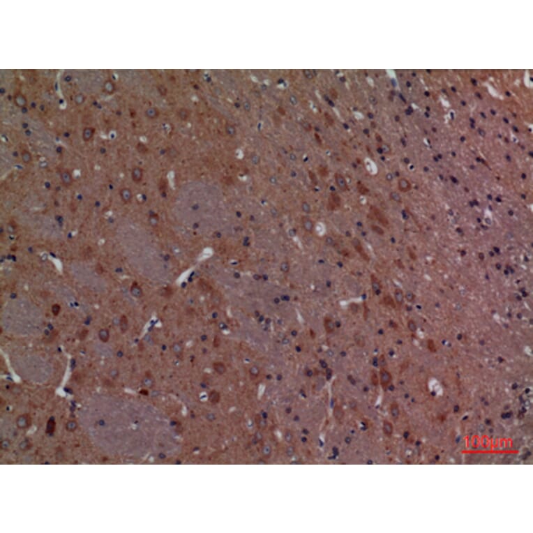 Immunohistochemistry - Anti-CALB1 Antibody (C30183) - Antibodies.com