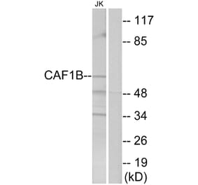 Western Blot - Anti-CAF1B Antibody (C10946) - Antibodies.com