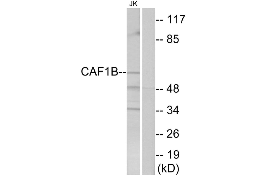 Western Blot - Anti-CAF1B Antibody (C10946) - Antibodies.com