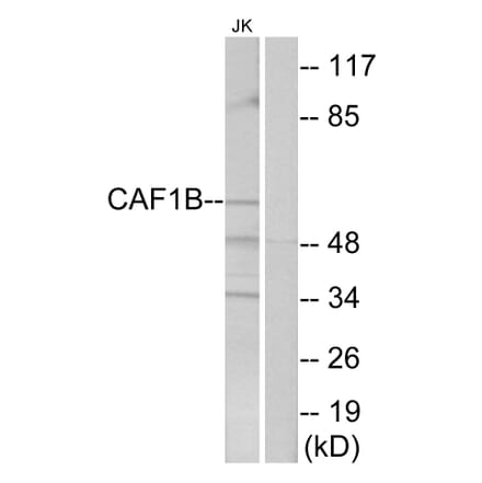 Western Blot - Anti-CAF1B Antibody (C10946) - Antibodies.com