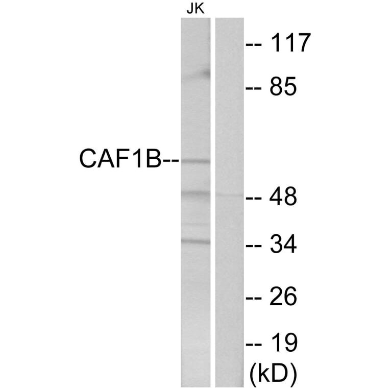 Western Blot - Anti-CAF1B Antibody (C10946) - Antibodies.com