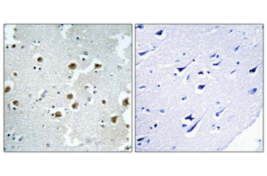 Immunohistochemistry - Anti-CAF1B Antibody (C10946) - Antibodies.com