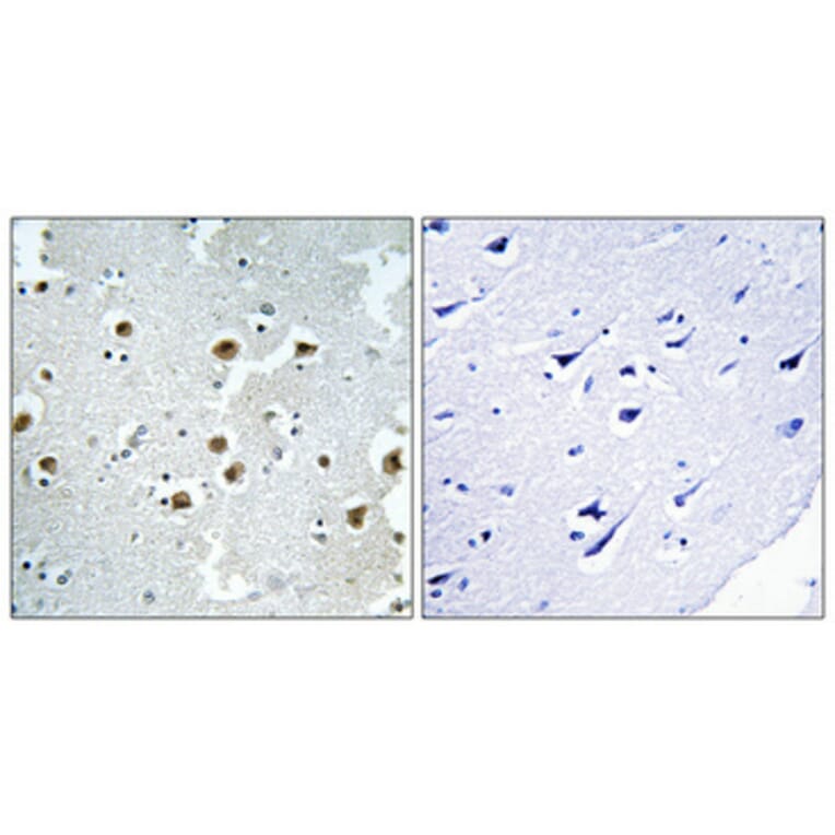 Immunohistochemistry - Anti-CAF1B Antibody (C10946) - Antibodies.com