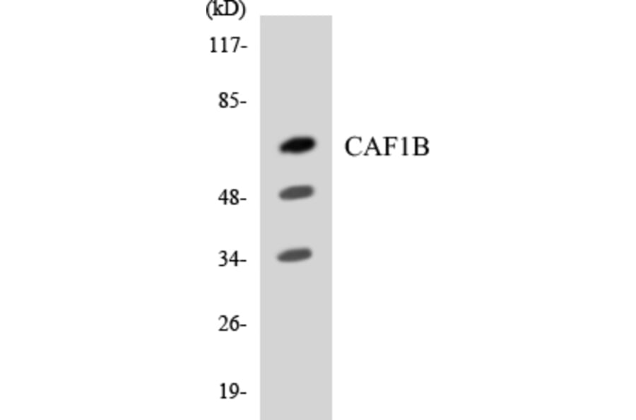 Western Blot - Anti-CAF1B Antibody (R12-2563) - Antibodies.com