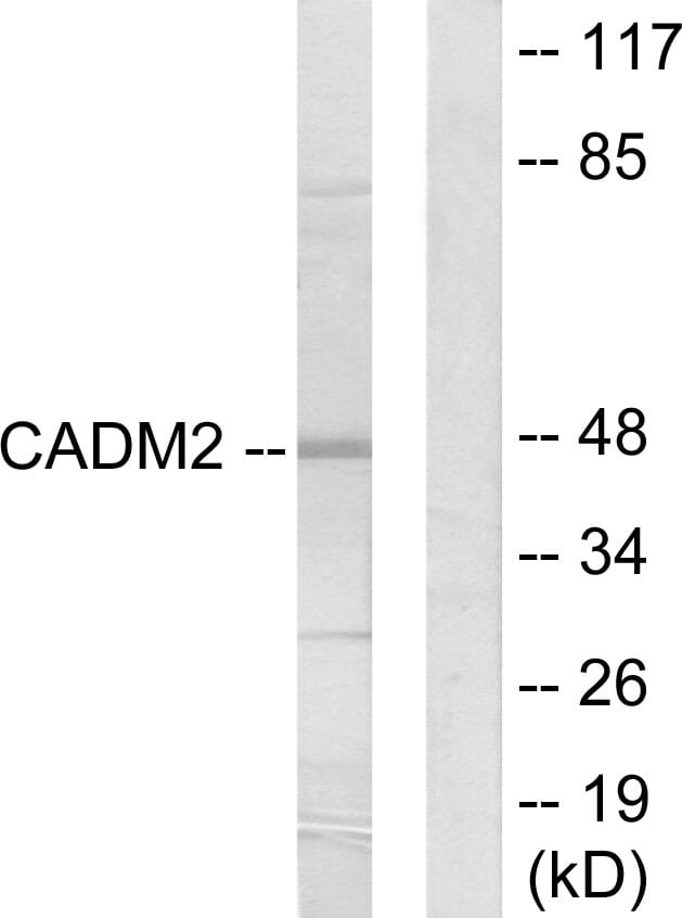 Western blot analysis of lysates from HepG2 cells using Anti-CADM2 Antibody. The right hand lane represents a negative control, where the antibody is blocked by the immunising peptide.