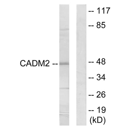 Western Blot - Anti-CADM2 Antibody (C12109) - Antibodies.com