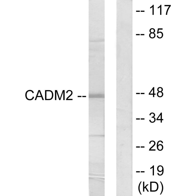 Western Blot - Anti-CADM2 Antibody (C12109) - Antibodies.com