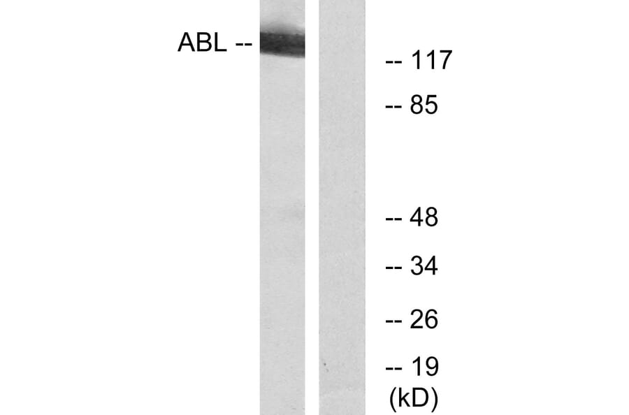 Western Blot - Anti-c-Abl Antibody (B7003) - Antibodies.com