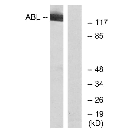 Western Blot - Anti-c-Abl Antibody (B7003) - Antibodies.com