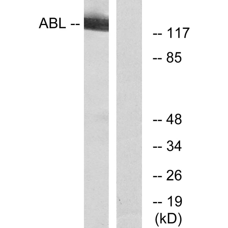 Western Blot - Anti-c-Abl Antibody (B7003) - Antibodies.com