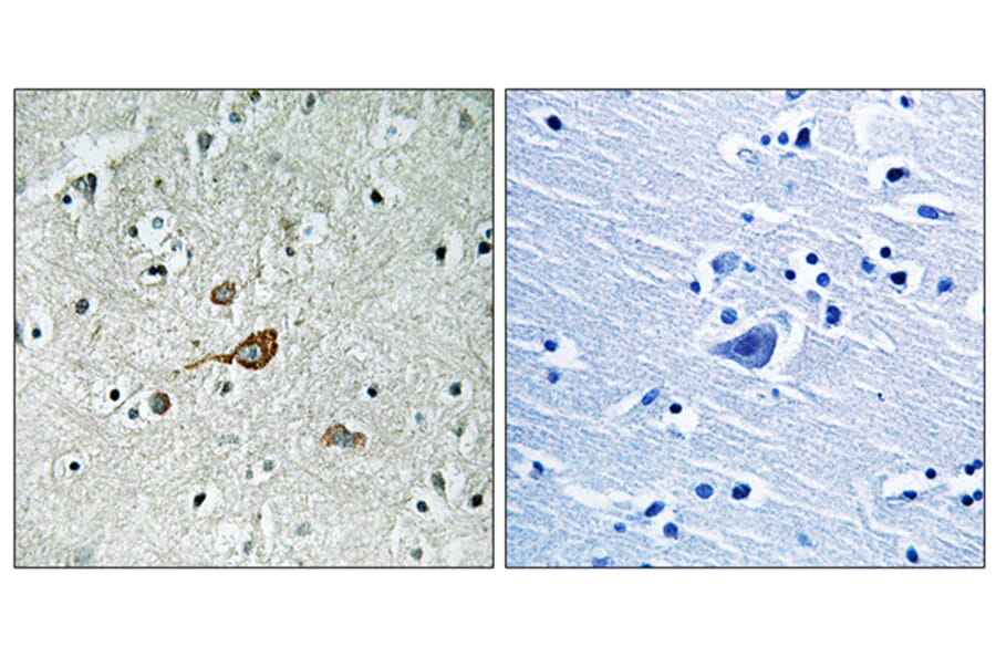 Immunohistochemistry - Anti-c-Abl Antibody (B7003) - Antibodies.com