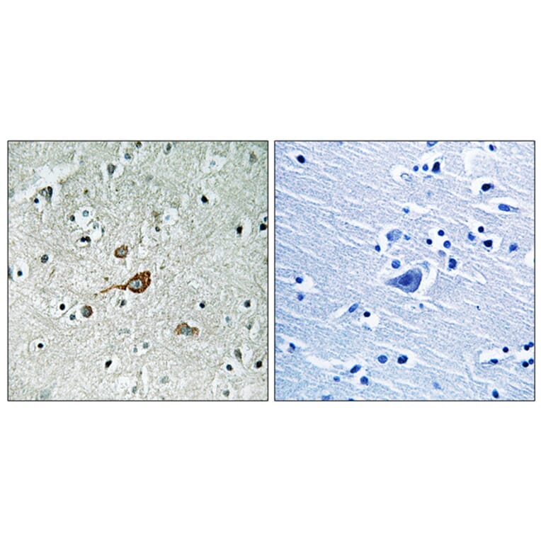 Immunohistochemistry - Anti-c-Abl Antibody (B7003) - Antibodies.com