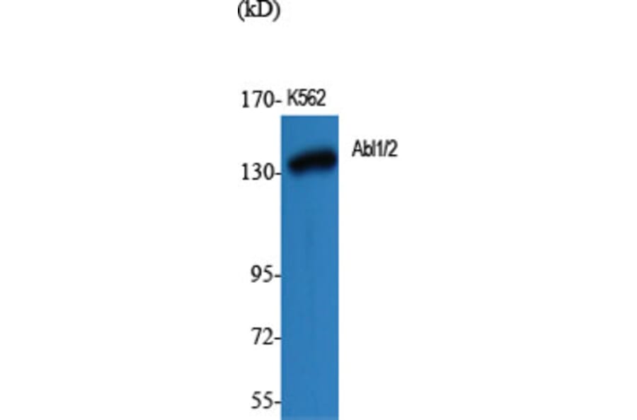 Western Blot - Anti-c-Abl Antibody (B7003) - Antibodies.com