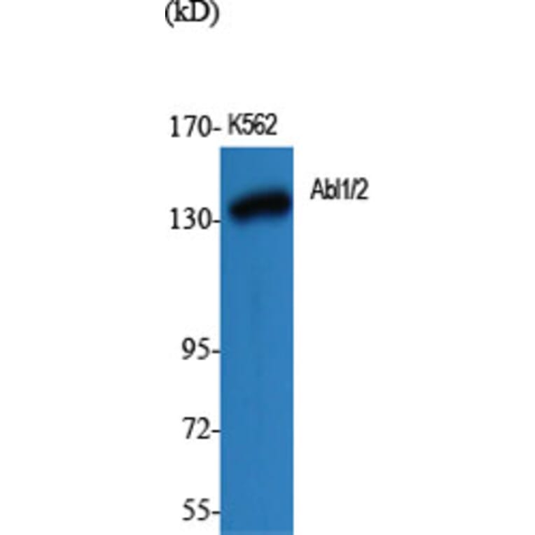 Western Blot - Anti-c-Abl Antibody (B7003) - Antibodies.com