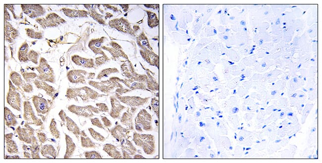 Immunohistochemical analysis of paraffin-embedded human heart tissue using Anti-BRWD3 Antibody. The right hand panel represents a negative control, where the antibody was pre-incubated with the immunising peptide.
