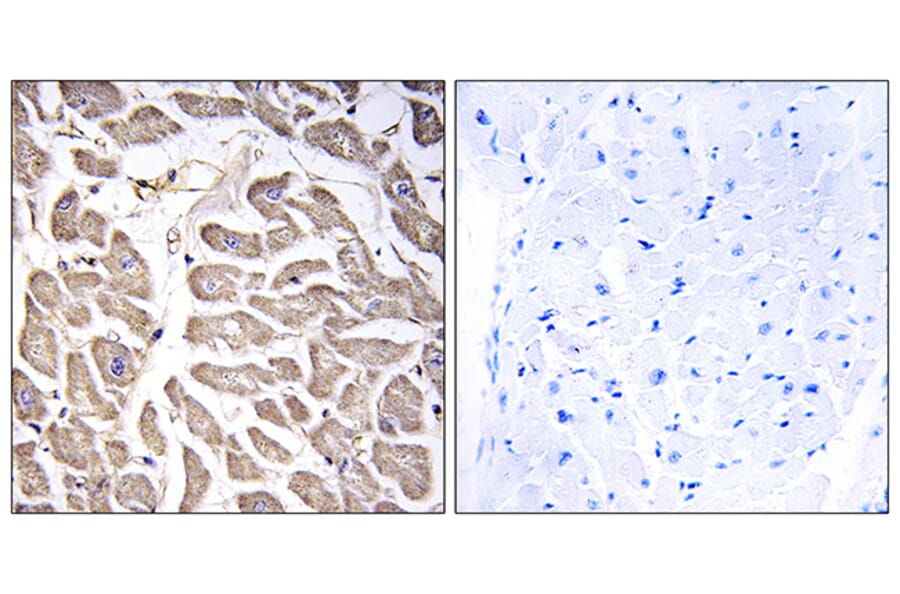 Immunohistochemistry - Anti-BRWD3 Antibody (C14807) - Antibodies.com