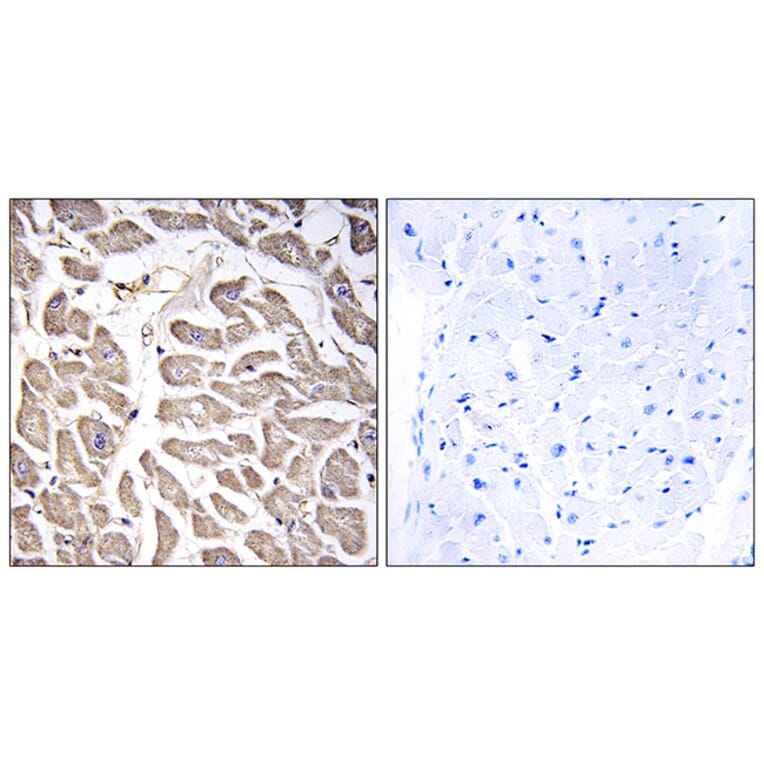 Immunohistochemistry - Anti-BRWD3 Antibody (C14807) - Antibodies.com