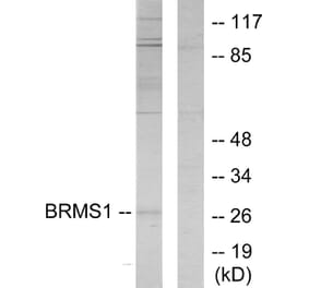 Western Blot - Anti-BRMS1 Antibody (C11729) - Antibodies.com