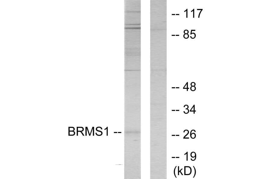 Western Blot - Anti-BRMS1 Antibody (C11729) - Antibodies.com