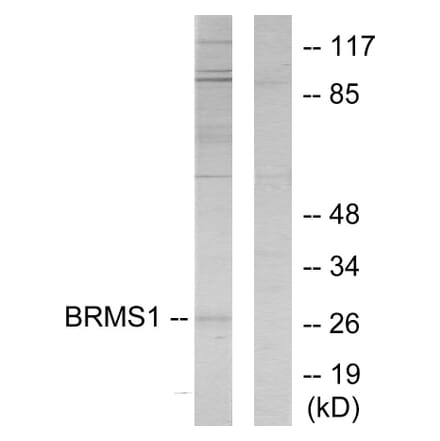 Western Blot - Anti-BRMS1 Antibody (C11729) - Antibodies.com