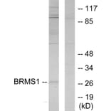 Western Blot - Anti-BRMS1 Antibody (C11729) - Antibodies.com