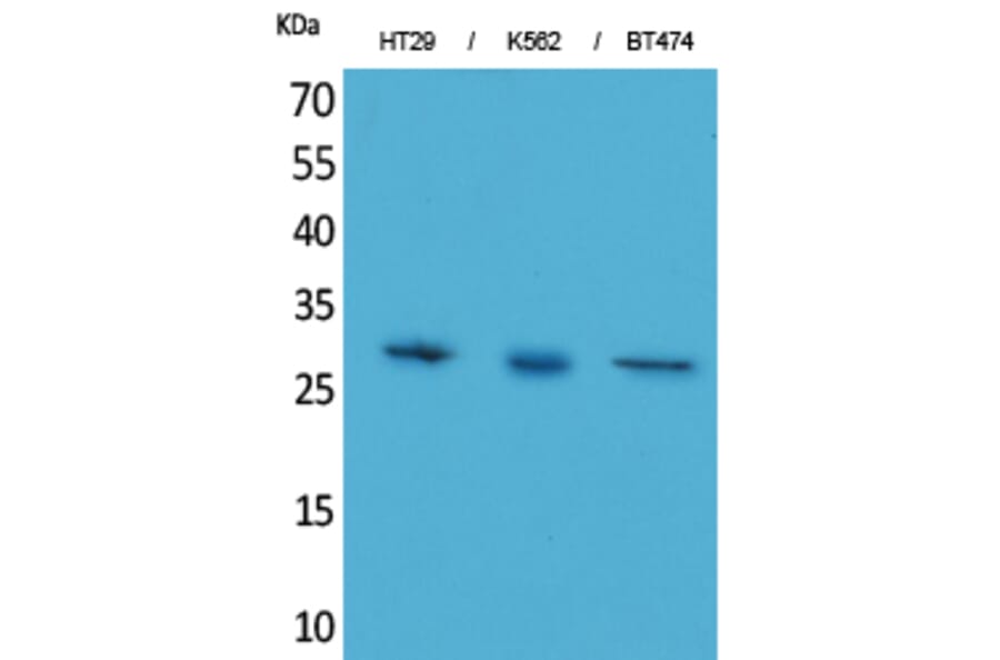 Western Blot - Anti-BRMS1 Antibody (C30036) - Antibodies.com