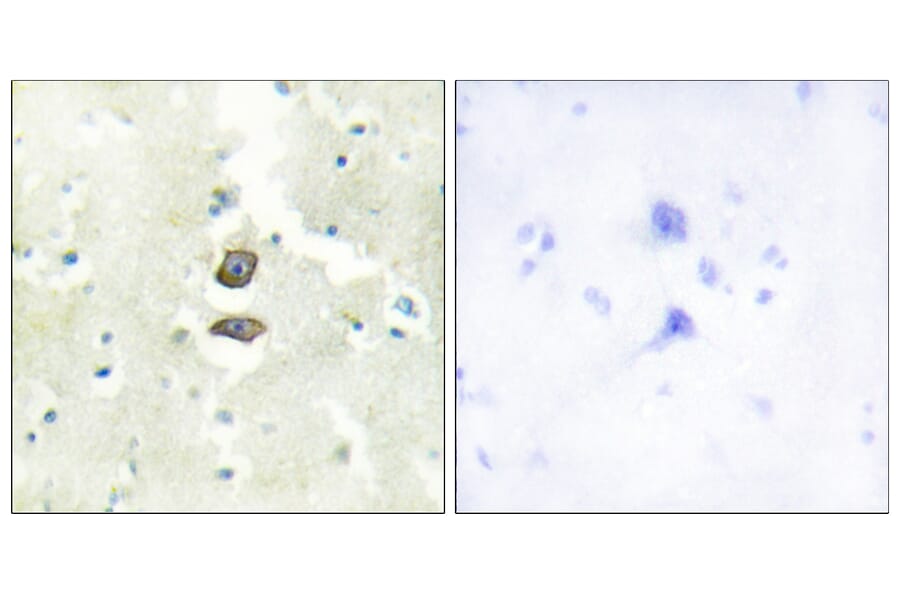 Immunohistochemistry - Anti-BRI3B Antibody (C11418) - Antibodies.com