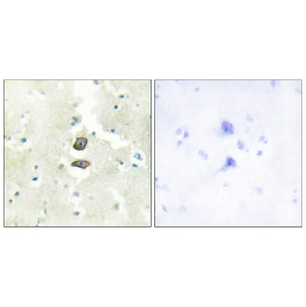 Immunohistochemistry - Anti-BRI3B Antibody (C11418) - Antibodies.com